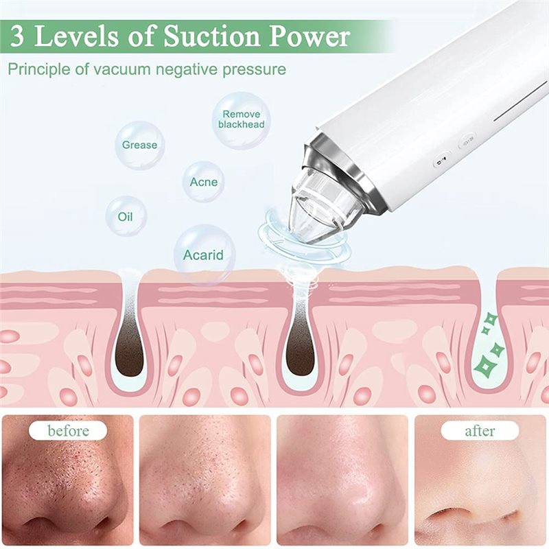 【FITTING】 Kit d'aspirateur de  - Home Improvement Kit avis et prix